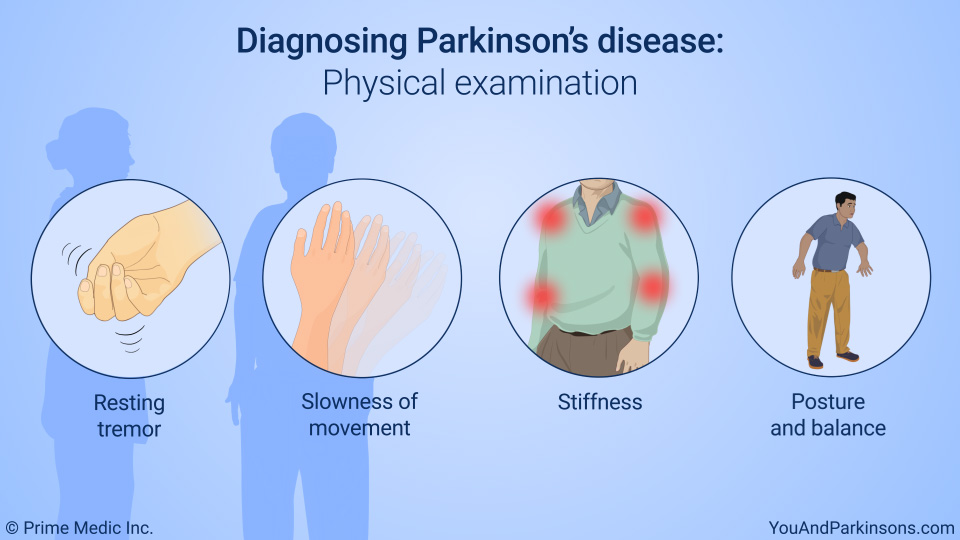 Slide Show Diagnosis Of Parkinson s Disease