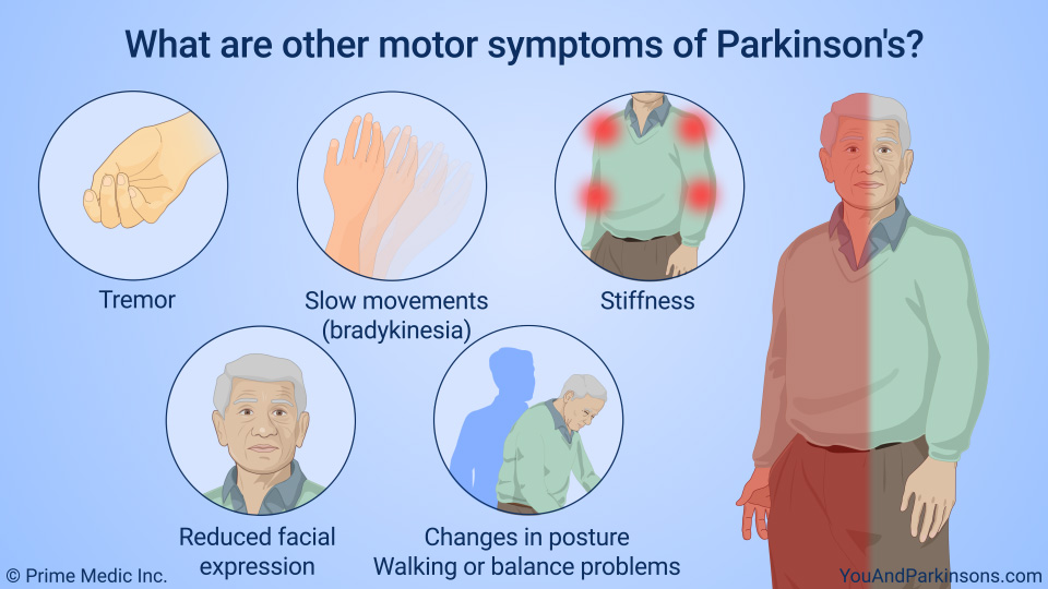 Slide Show Understanding Parkinson s Disease